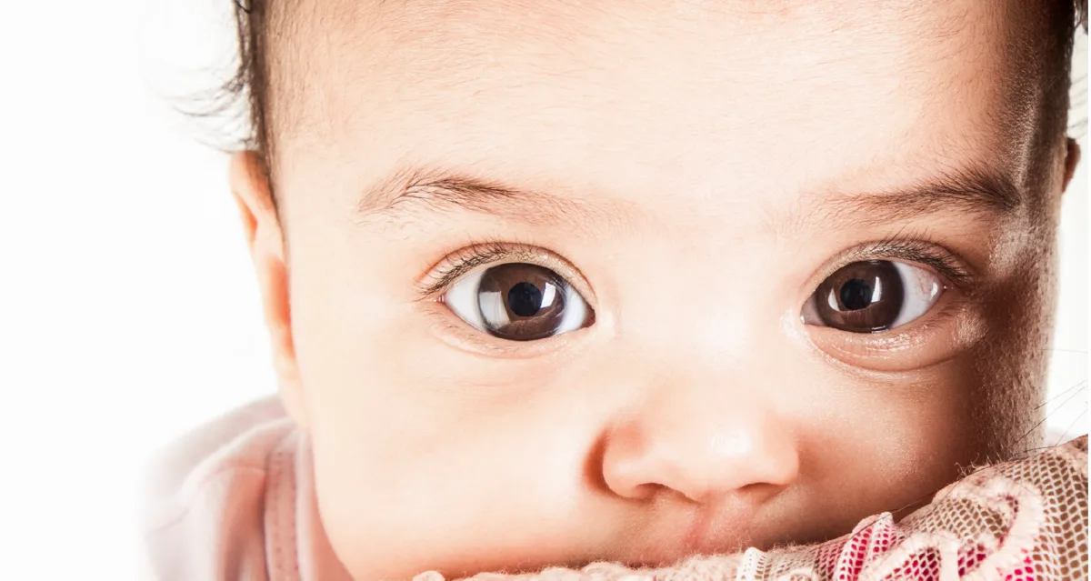 Retinoblastoma: Kanker Mata pada Balita yang Perlu Deteksi Dini